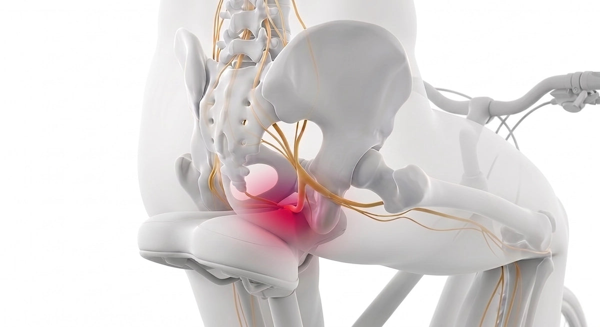 Vue de dessus : ischions débordant d'une assise étroite, appui sur les bords